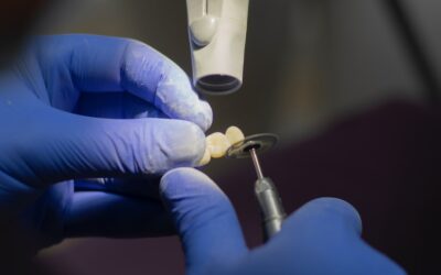 Debunking Common Misconceptions About Dental Implants